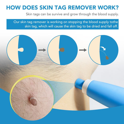 Florea™ Auto Tag Removal Kit